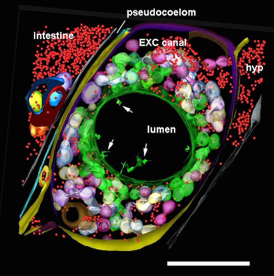 ETFIG 6: Annotated adult excretory cell